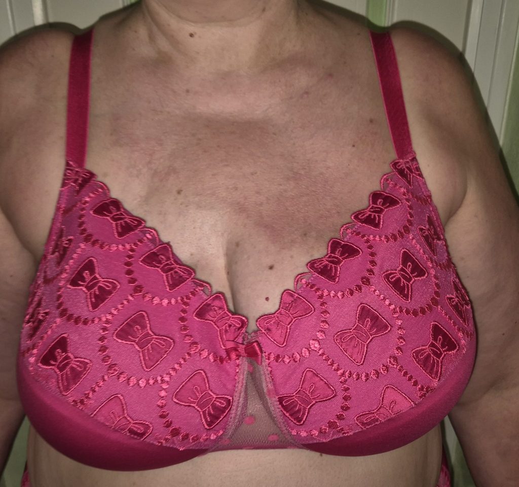 Lingerie post-mastectomie rennes